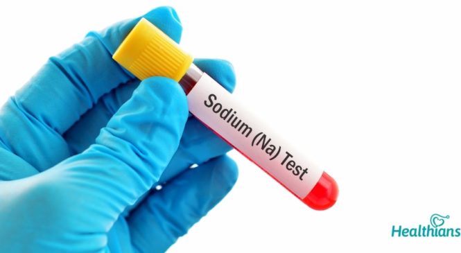 Sodium serum test – Need, Uses & Results