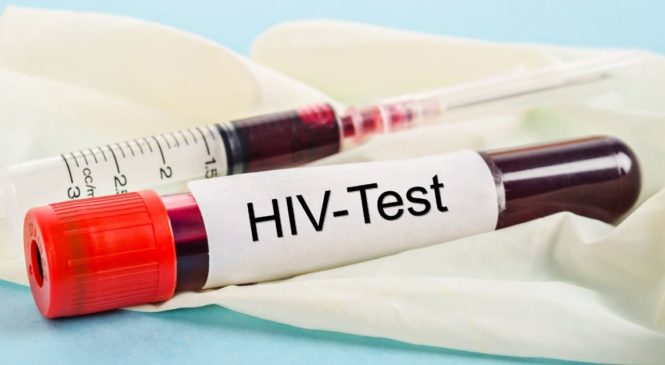 HIV Test: 1 & 2 Antibodies