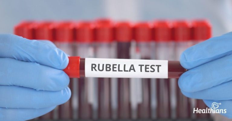 rubella-igm-igg-test-purpose-results-range-healthians-blog