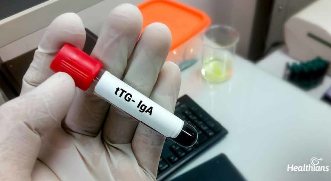 What is a Tissue Transglutaminase IgA, IgG Test?