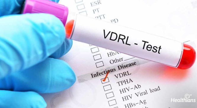 Venereal Disease Research Laboratory (VDRL) Test