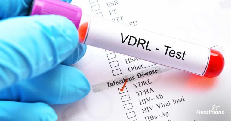 Venereal Disease Research Laboratory (VDRL) Test - HEALTHIANS BLOG