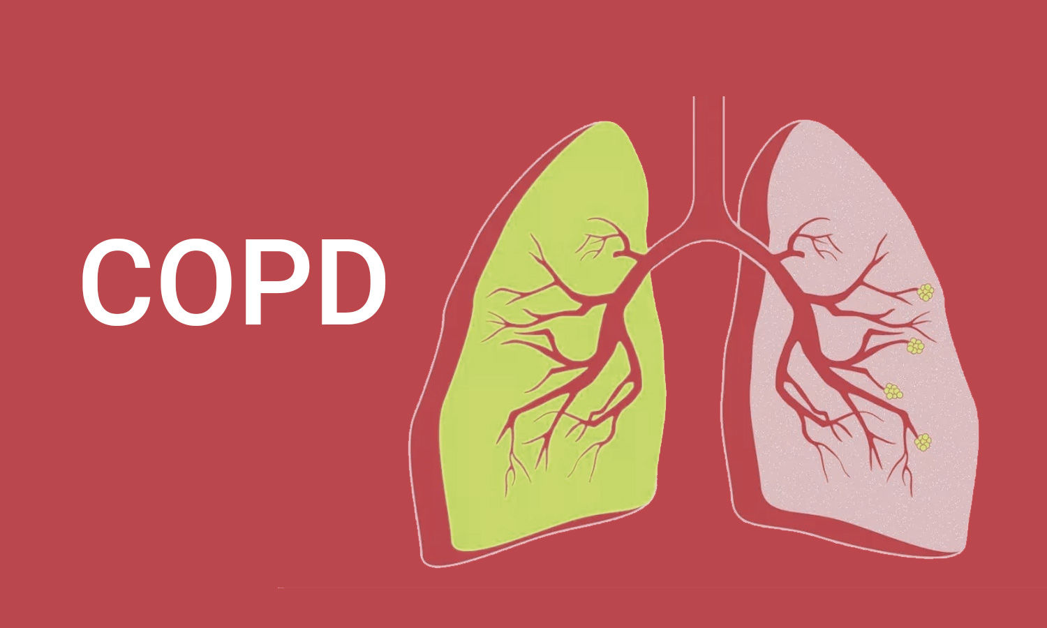 lungs infected with COPD