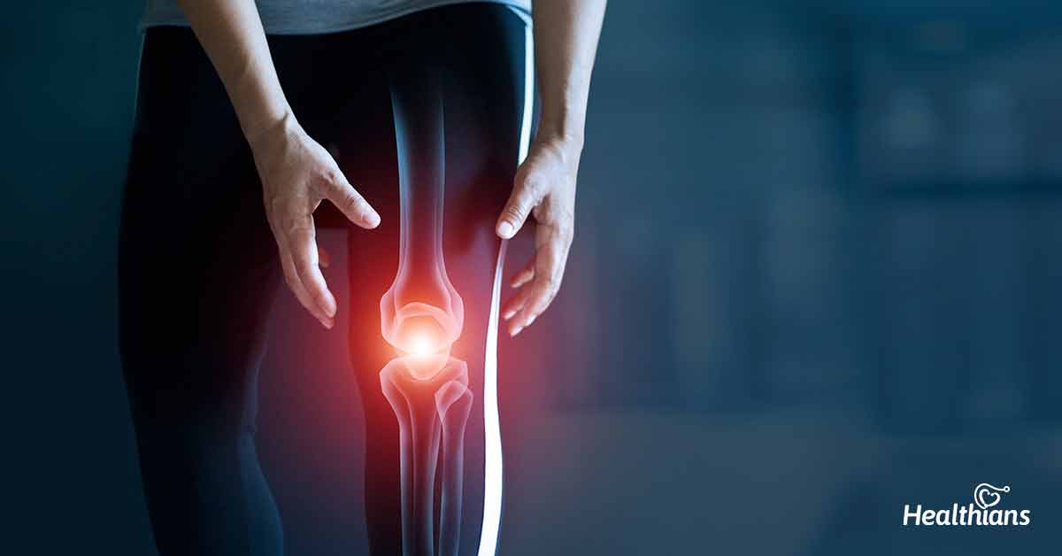 Osteoarthritis: How Your Joints Get Damaged & What To Do About It