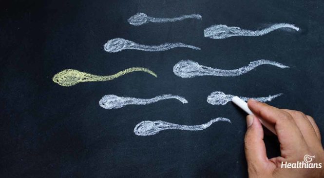 Male Infertility: Causes, Treatment & Lifestyle Changes