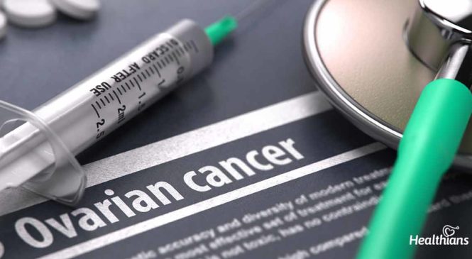 Ovarian Cancer: Overview, Symptoms, Causes & Management