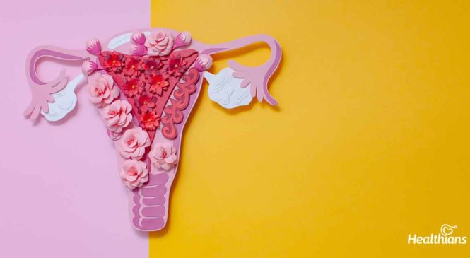 Endometriosis: Meaning, Symptoms, Risk Factors & Treatment