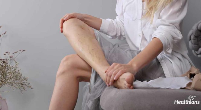 5 Steps To Improve Poor Blood Circulation In Your Legs