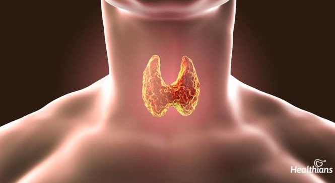 Mythbusters Diaries (Part 3): Debunking Top 7 Myths About Thyroid Disorders