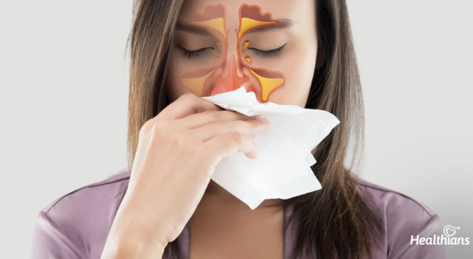 How To Treat Sinusitis Infection & What Causes Sinus Pain