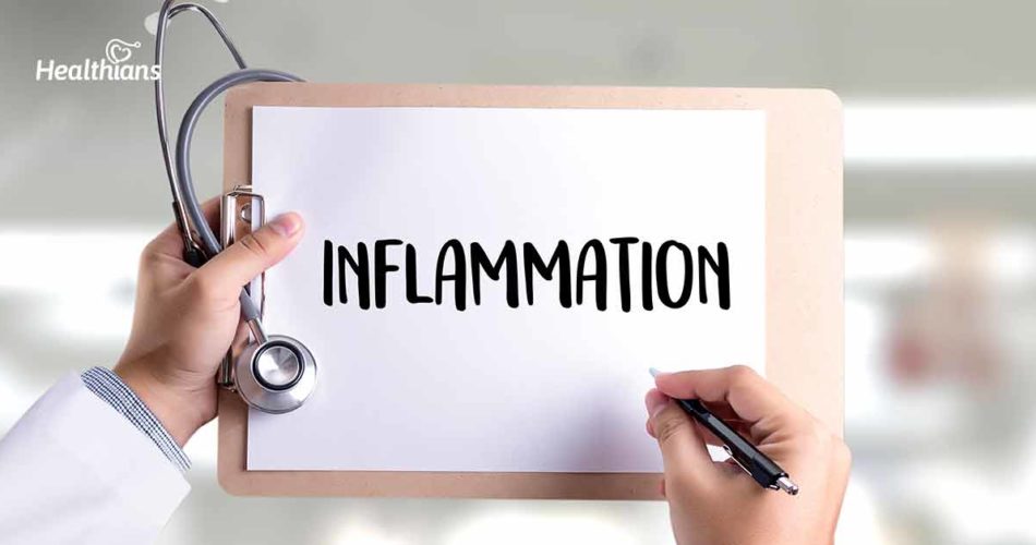 Inflammation: The 12 Most Frequently Asked Questions