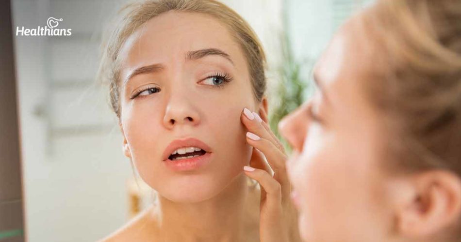 How to Get Rid of Puffy Cheeks and Swollen Face Appearance