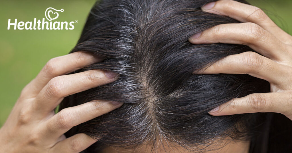 7 Best Effective Tips to Reduce Premature Greying of Hair!